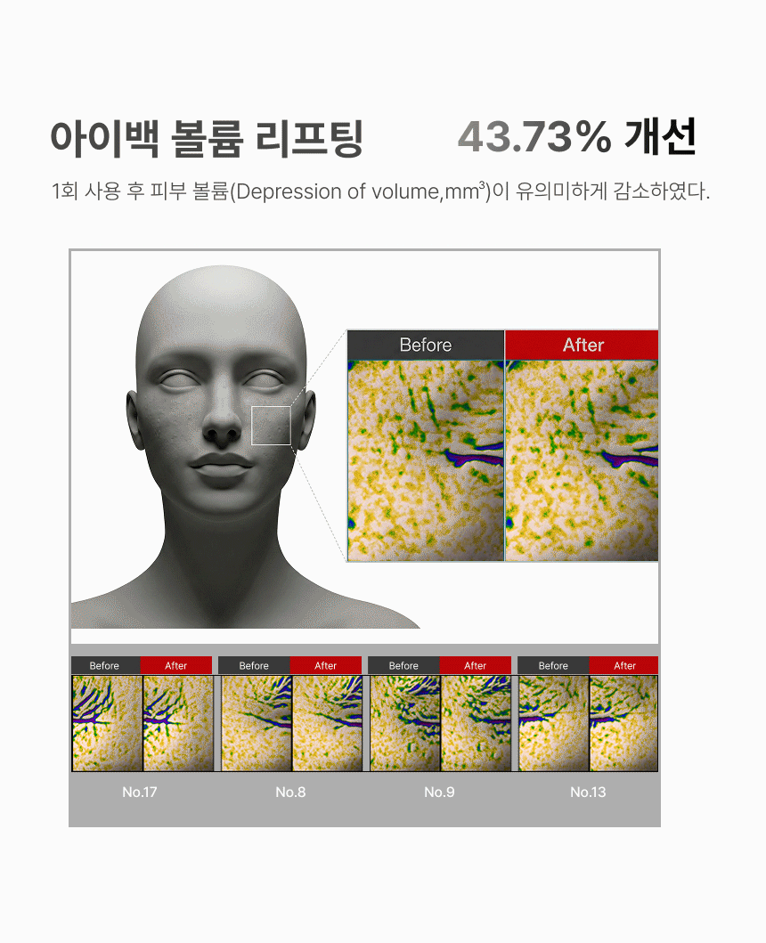 상세이미지_12