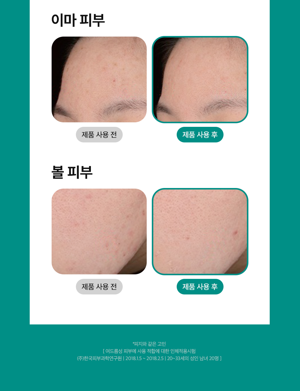 상세이미지_6